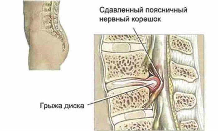 Рекомендации врача невролога