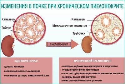 Как обжаловать решение призывной комиссии