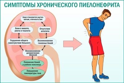 Категории годности к службе